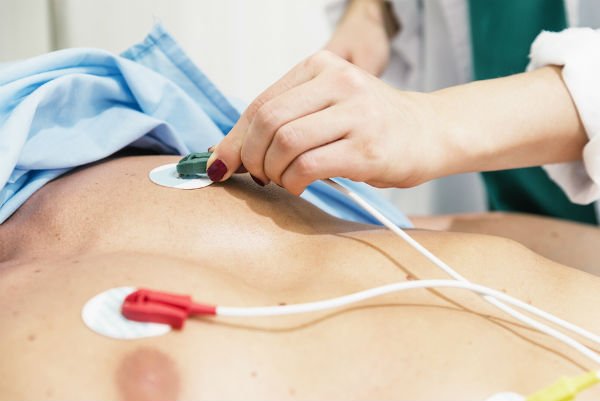 Eletrocardiograma – O que é, como funciona 3 Eletrocardiograma