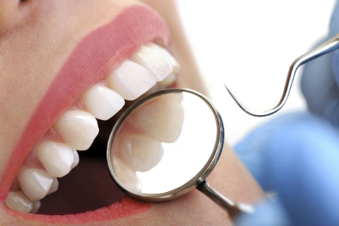 Prótese Dentária: O que é e quais são os tipos 2